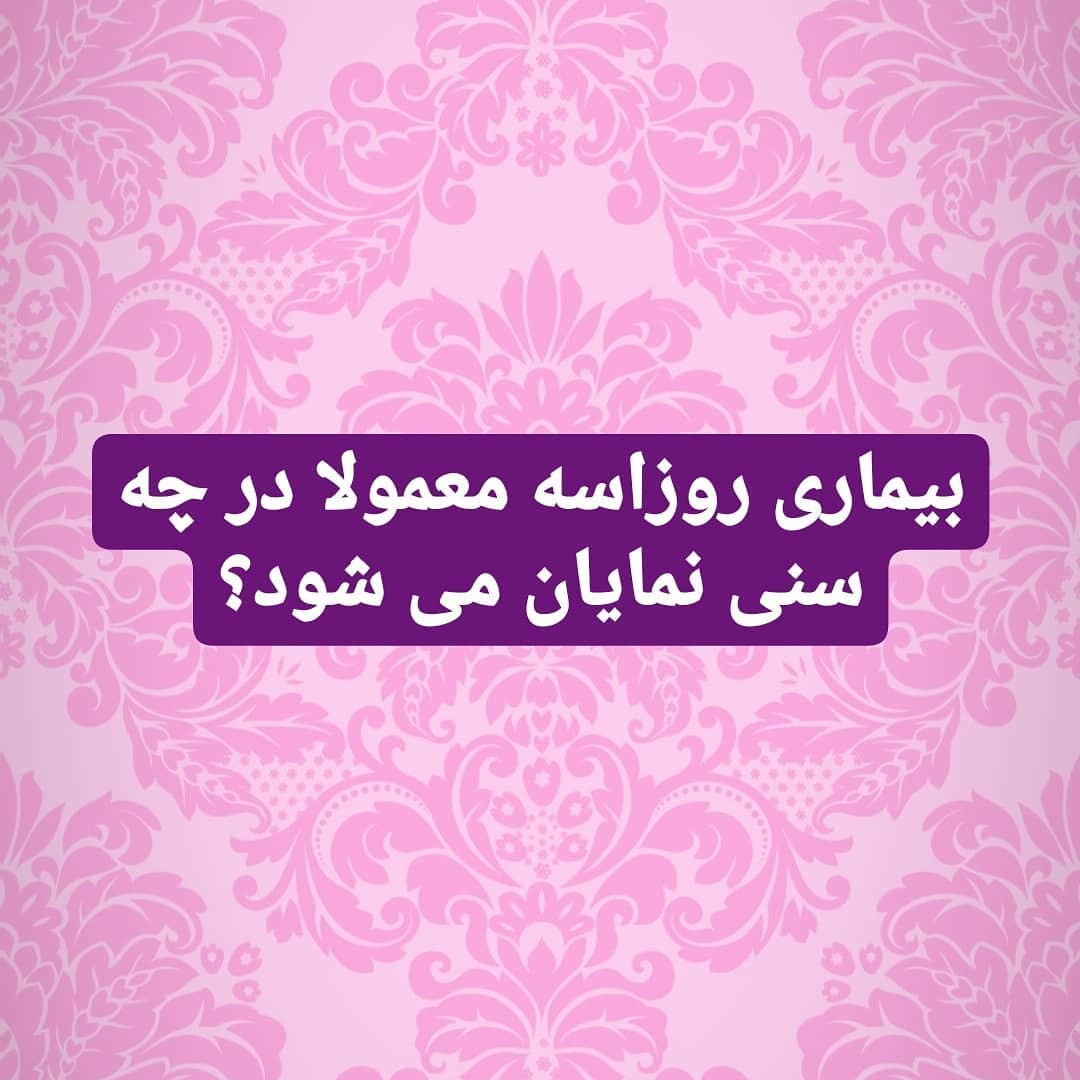 بیماری روزاسه معمولا در چه سنی نمایان می شود؟