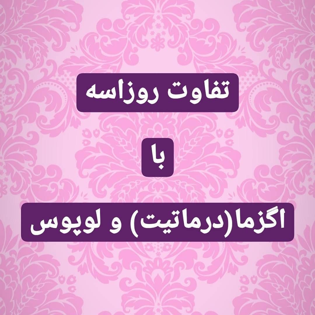 تفاوت روزاسه با اگزما و لوپوس