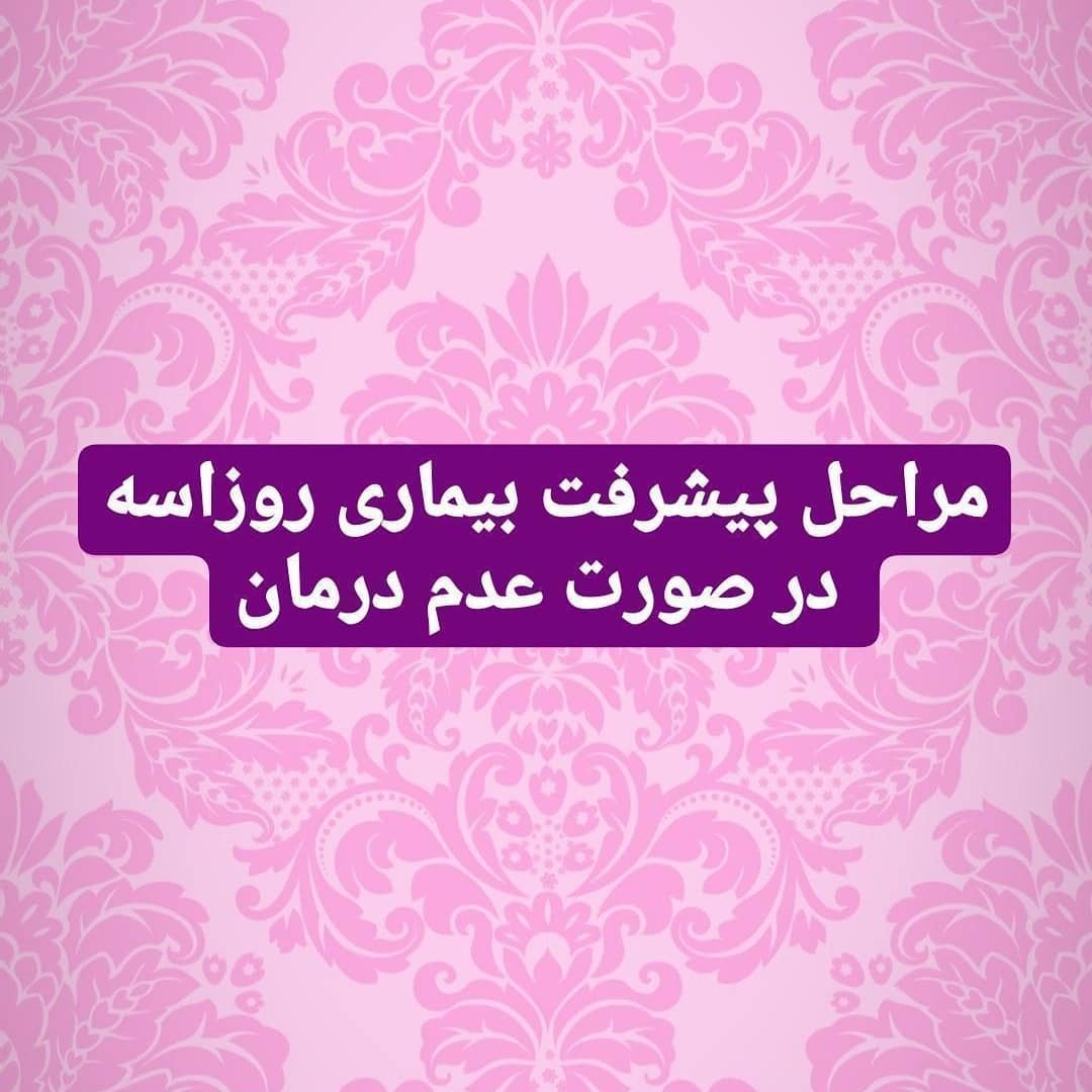 مراحل پیشرفت بیماری روزاسه در صورت عدم درمان
