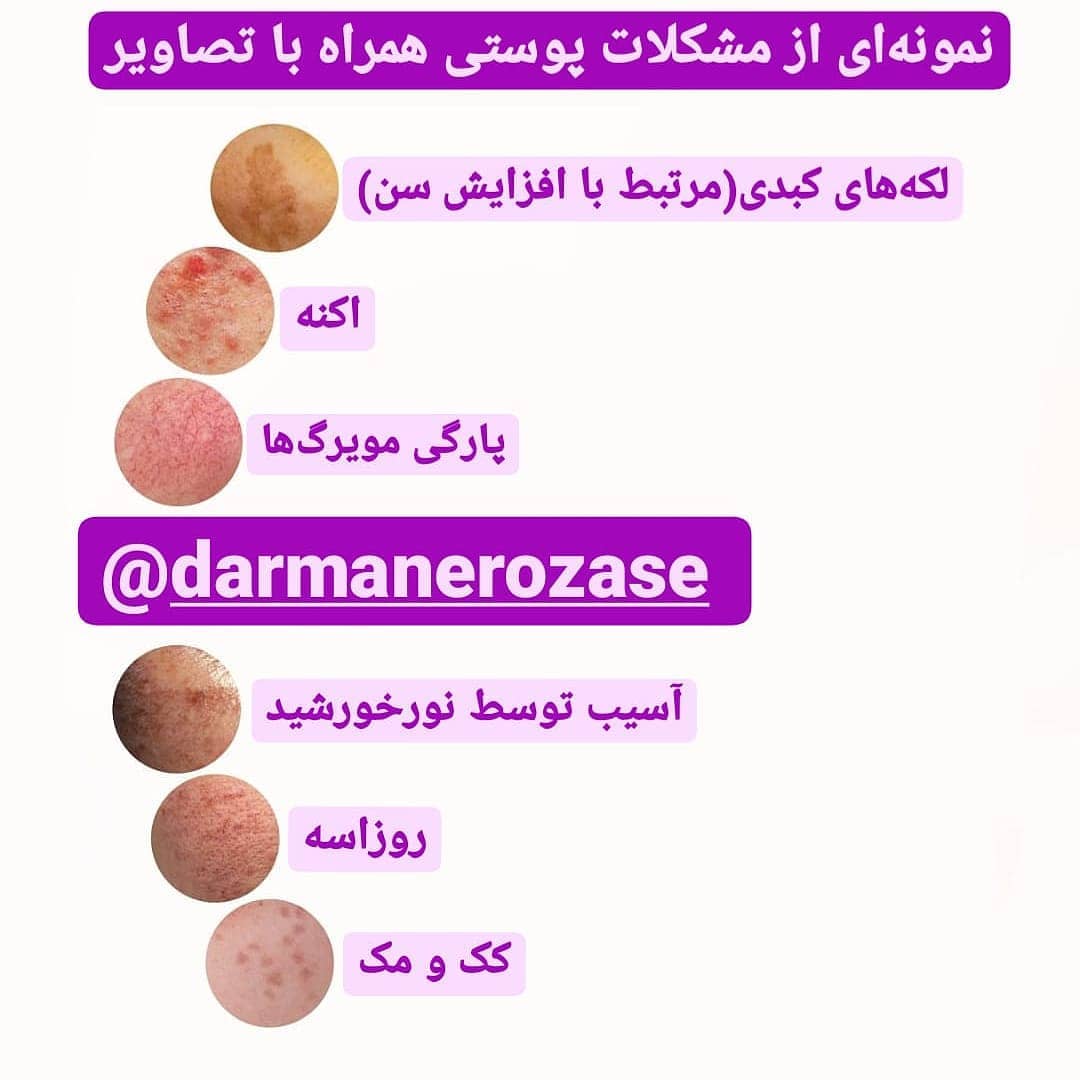 نمونه‌ای از مشکلات پوستی همراه با تصاویر